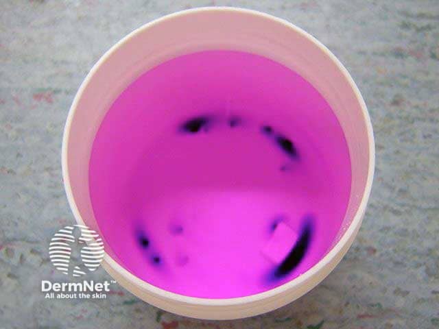 Diluted potassium permanganate - follow manufacturer instruction.