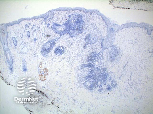 Figure 9