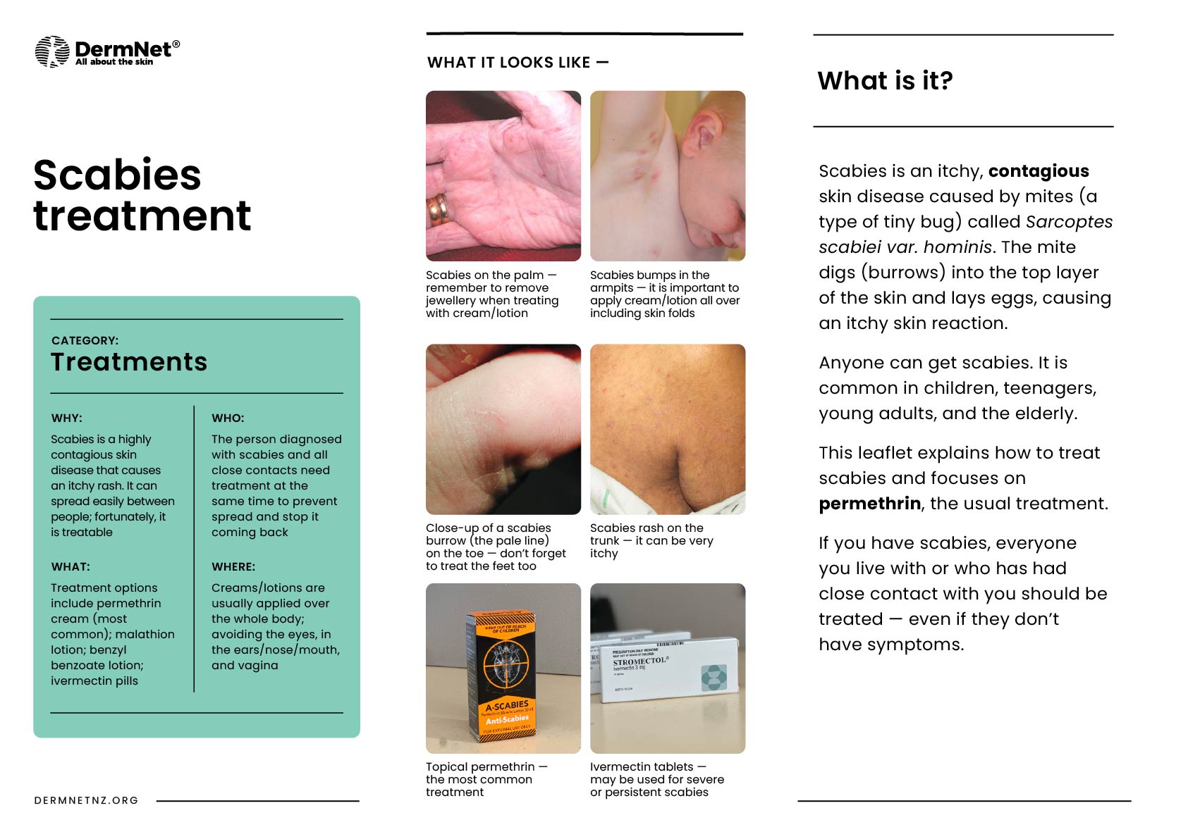 Scabies treatment